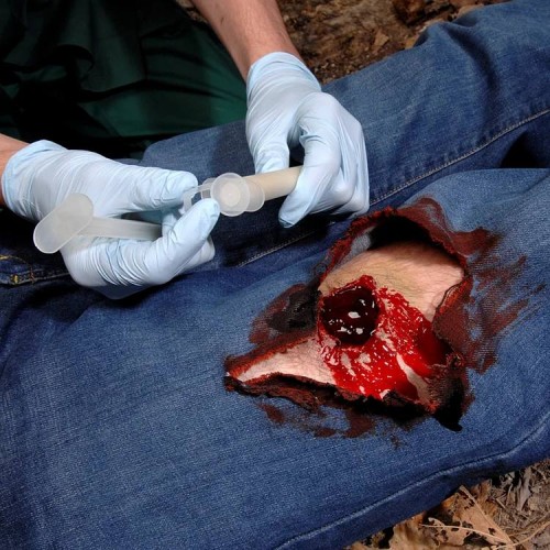 Аппликатор гемостатический с гранулами Rhino Rescue в Бердске хитозановый